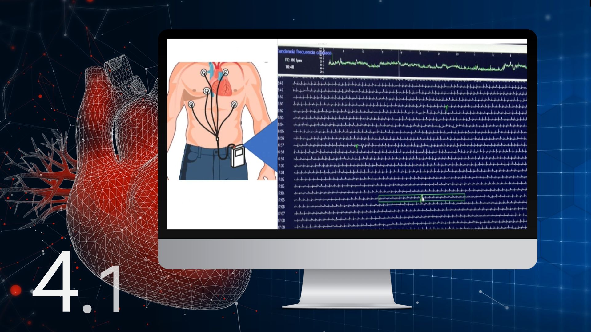 4-1-interpretaci-n-del-electrocardiograma-en-el-holter-doryos